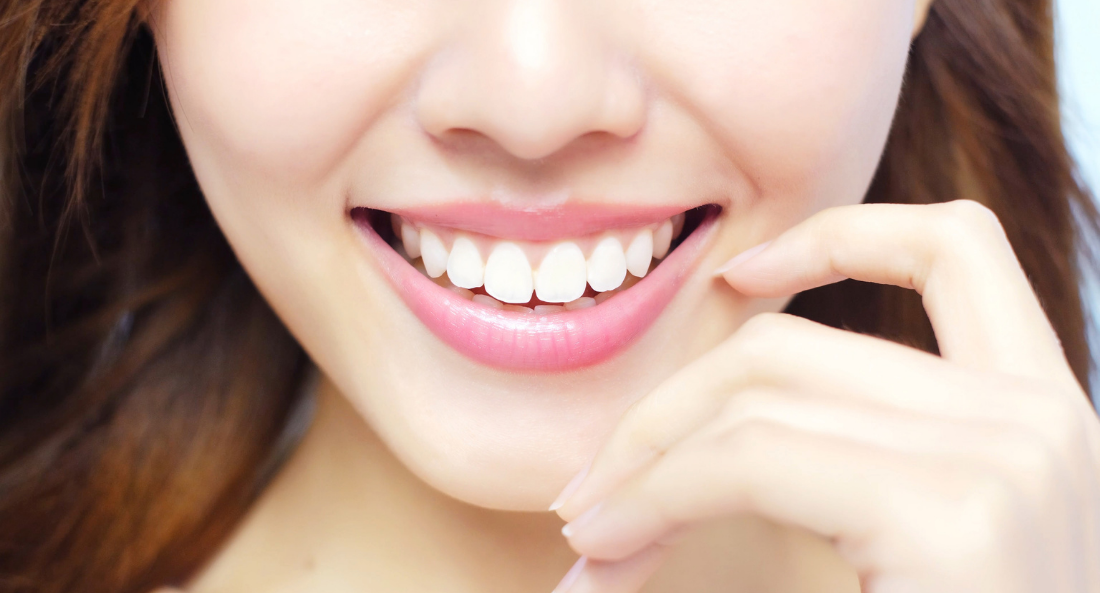 Beautiful Smiles