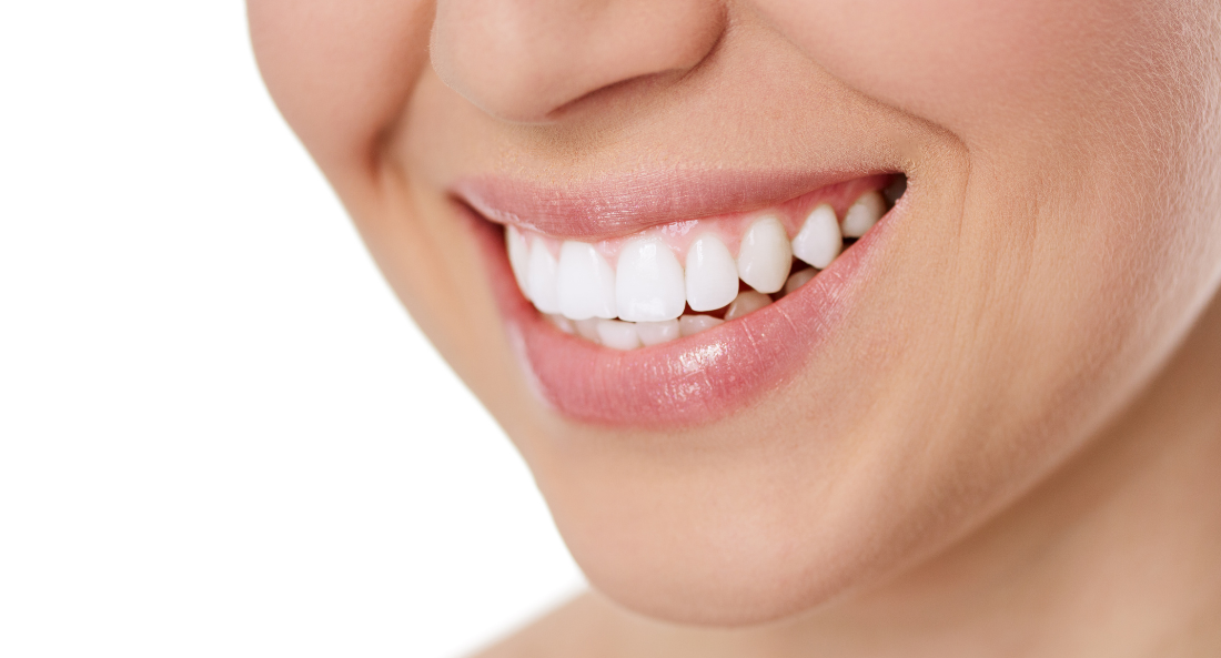 Teeth Whitening
